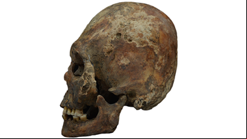 Crânio de uma mulher com modificação craniana encontrado em um enterro da era Hun - Tamás Hajdu, Universidade Eötvös Loránd